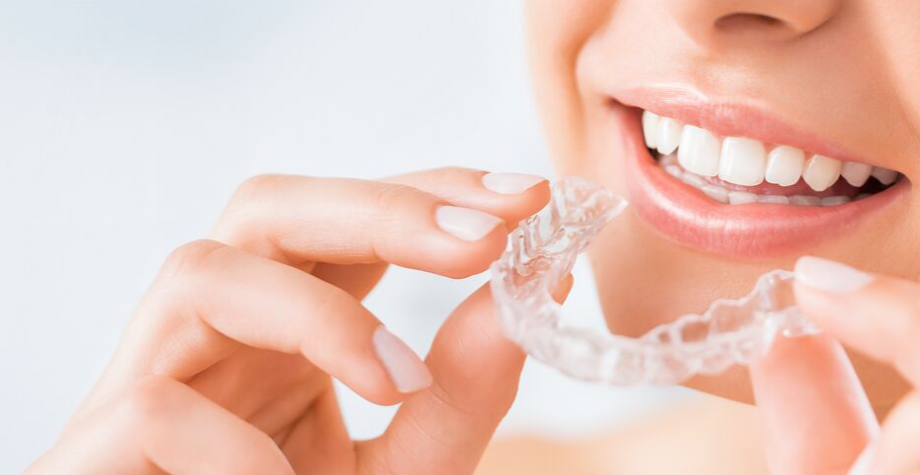 clear braces the modern approach to straight teeth with active aligners