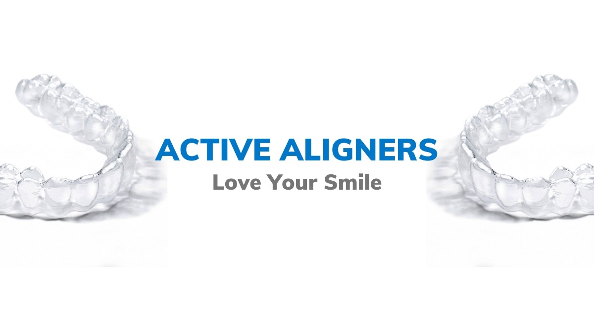 Clear aligners, invisible braces, active aligners