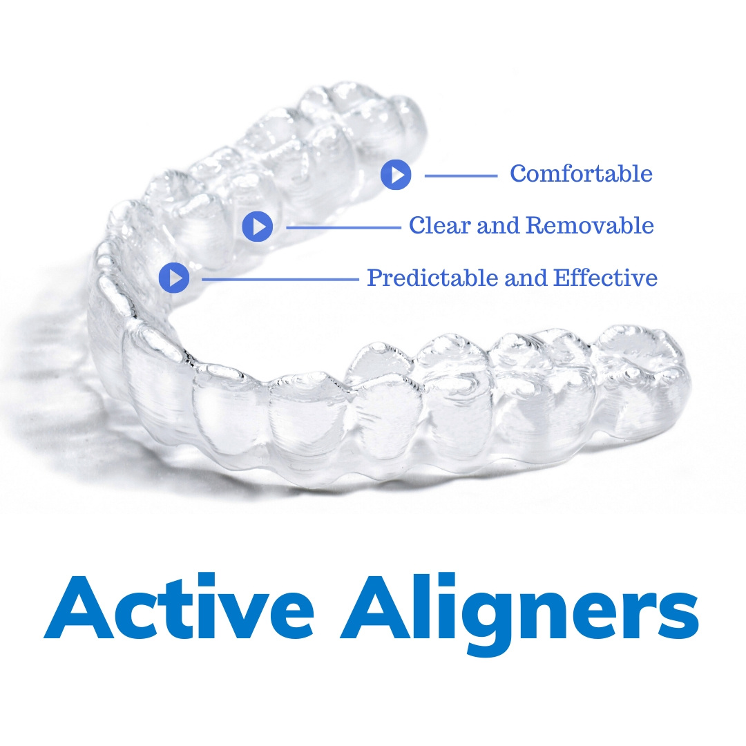 Active Aligners - Online Course - Image 1