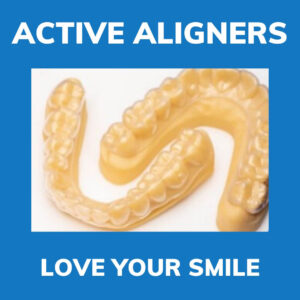 Active Aligner 3D printed display