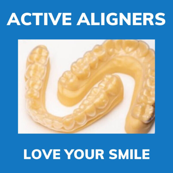 Active Aligner 3D printed display