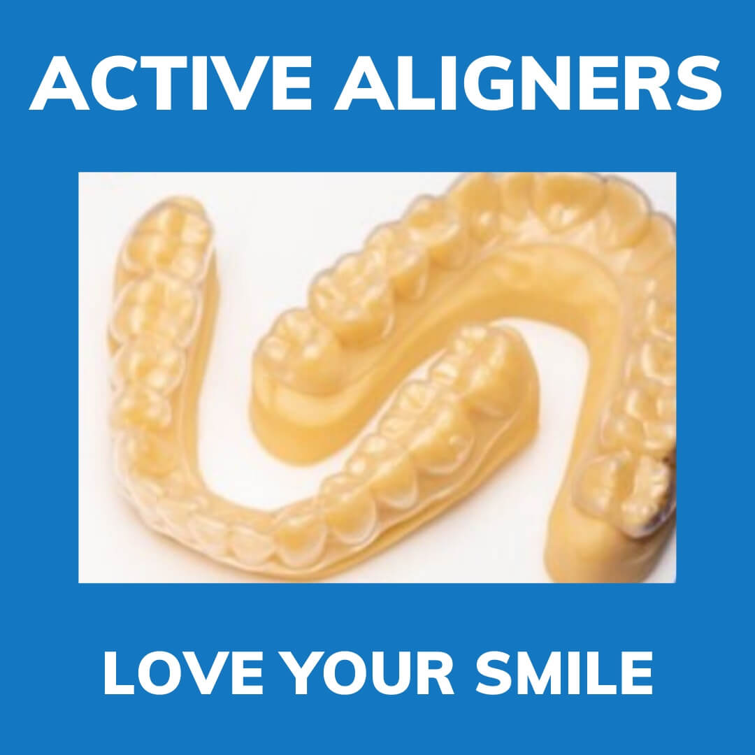 Active Aligner 3D printed display - Image 1