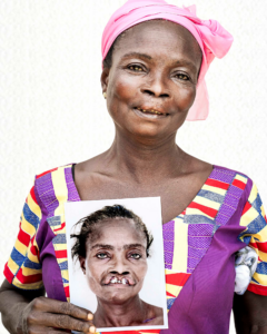 Akosua