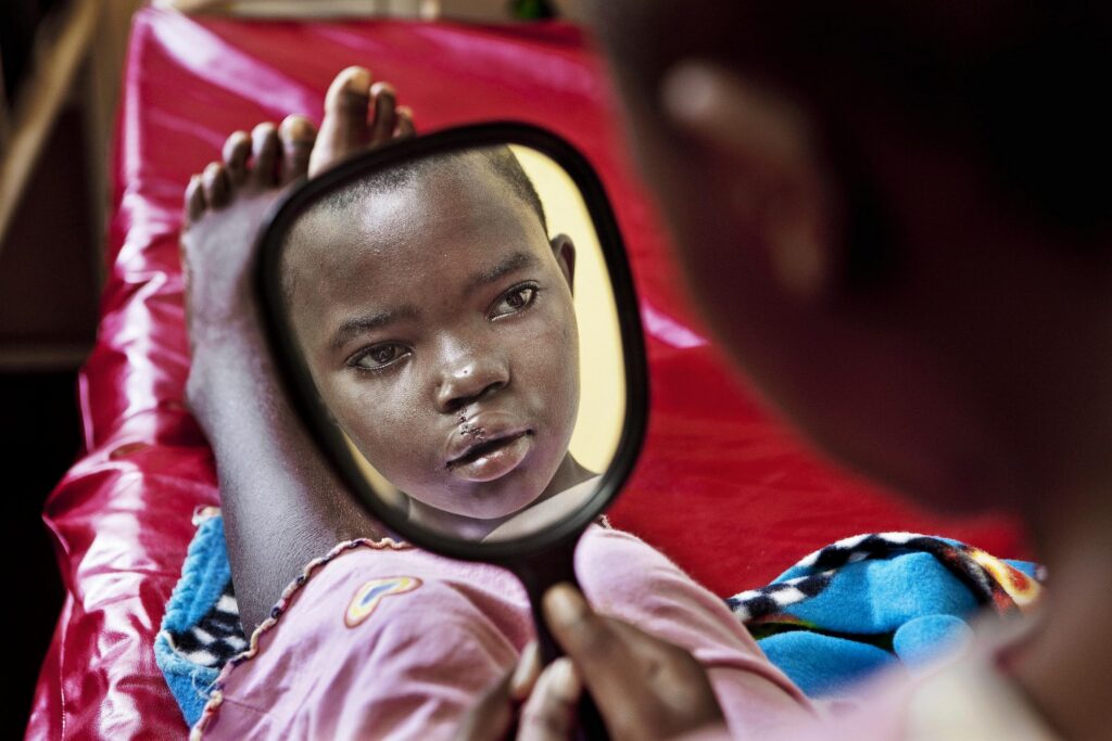 Operation Smile global volunteer medical team