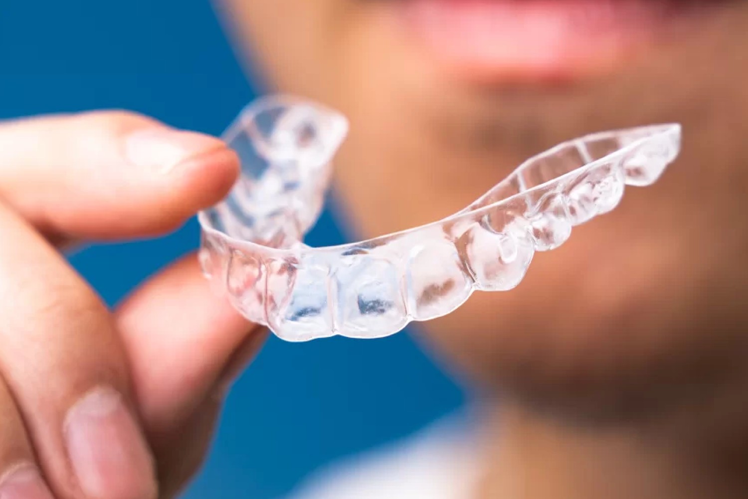 A clear aligner gripped between an index finger and thumb